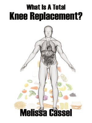 cover image of What Is A Total Knee Replacement?